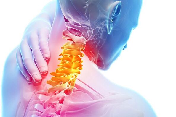 Le cause dell'osteocondosi cervicale